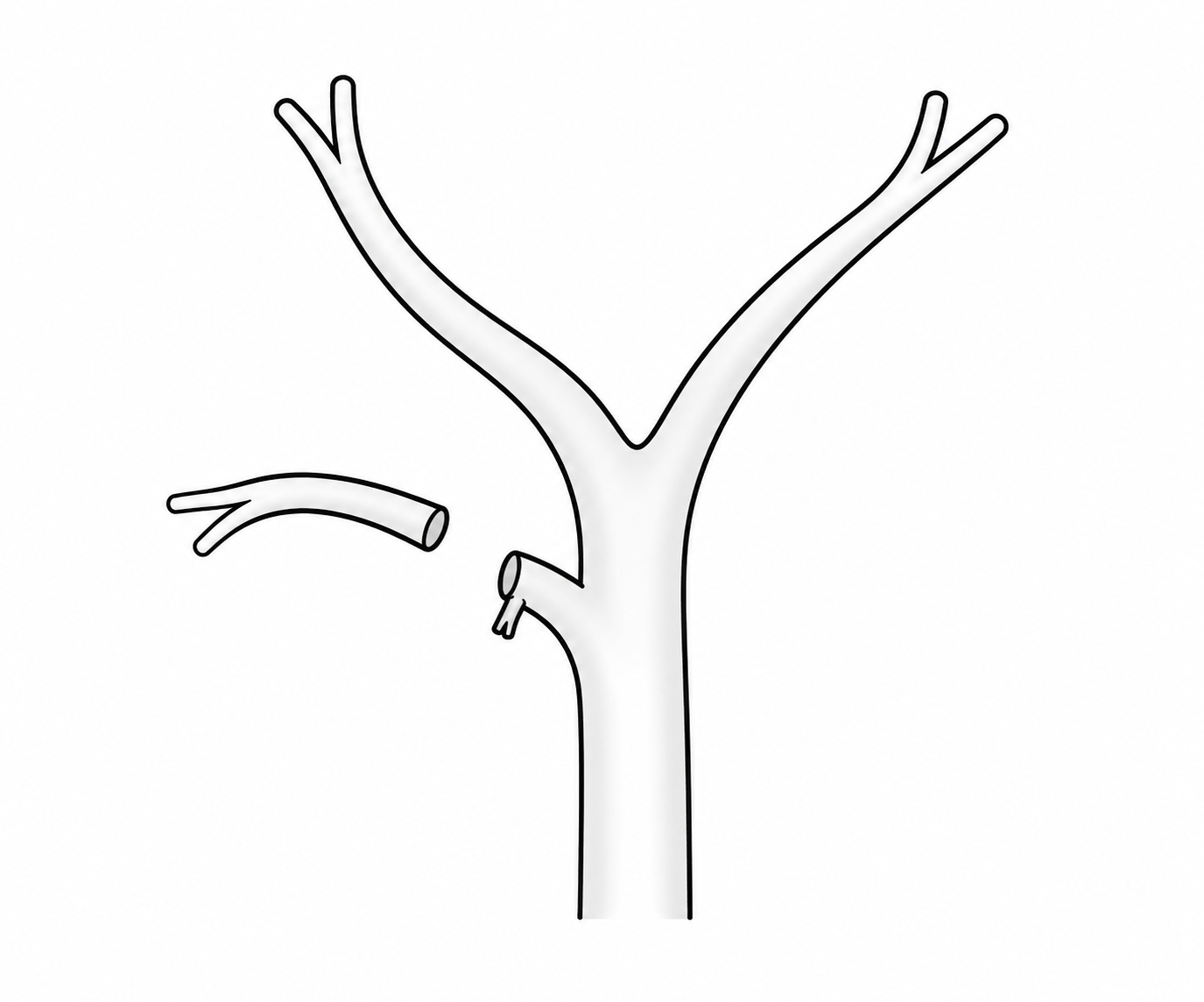 conditions.bileDuctInjury